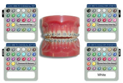 Cores brackets - Aparelho Interativo