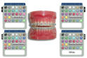 Cores brackets - Aparelho Interativo