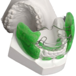 Ortopedia funcional dos maxilares